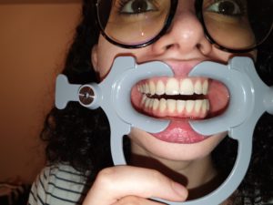 photos in dental monitoring back teeth not visible