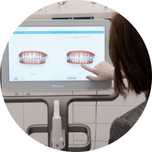 how to fast track your orthodontic treatment