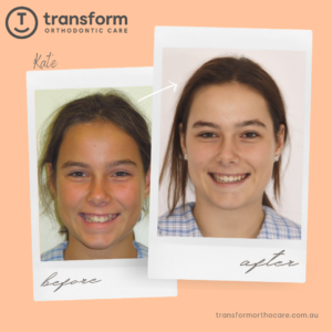 Smile makeover by Adelaide's top orthodontist
