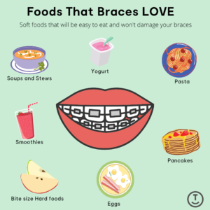 Foods that braces love