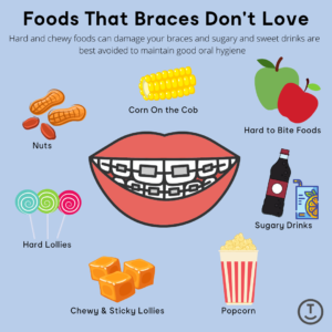Foods that braces don't love